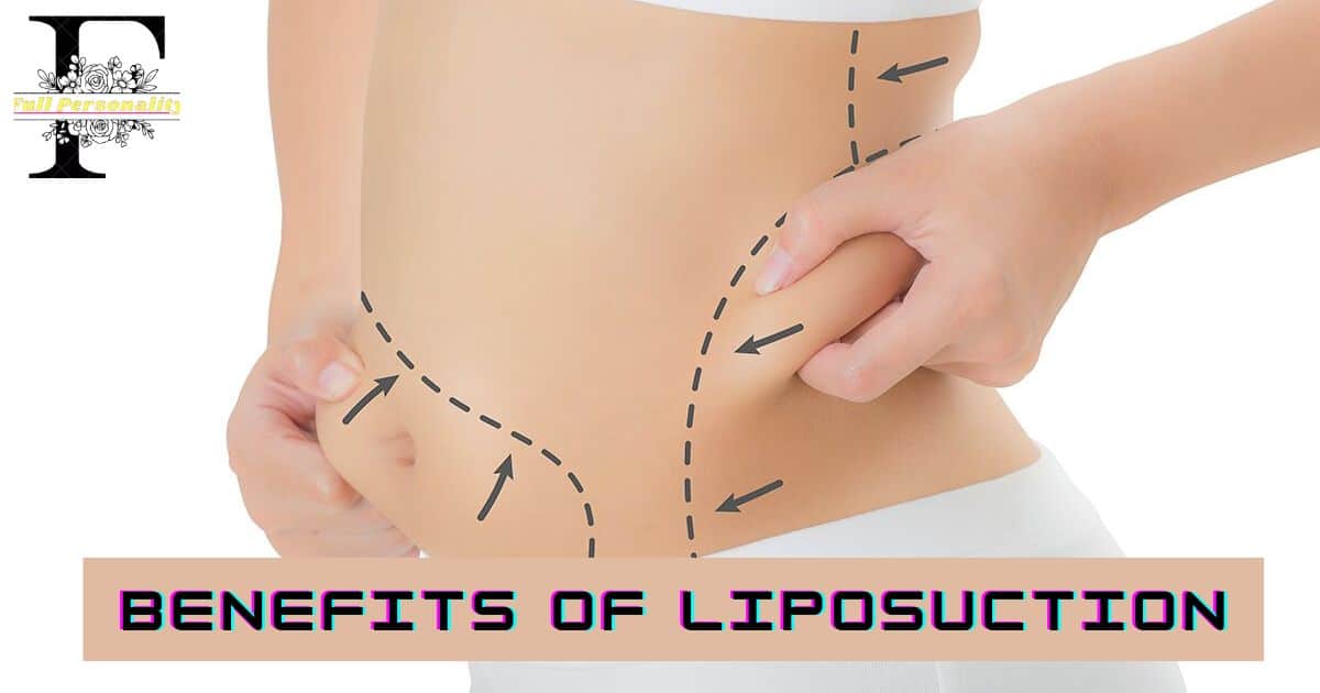 Benefits of Liposuction